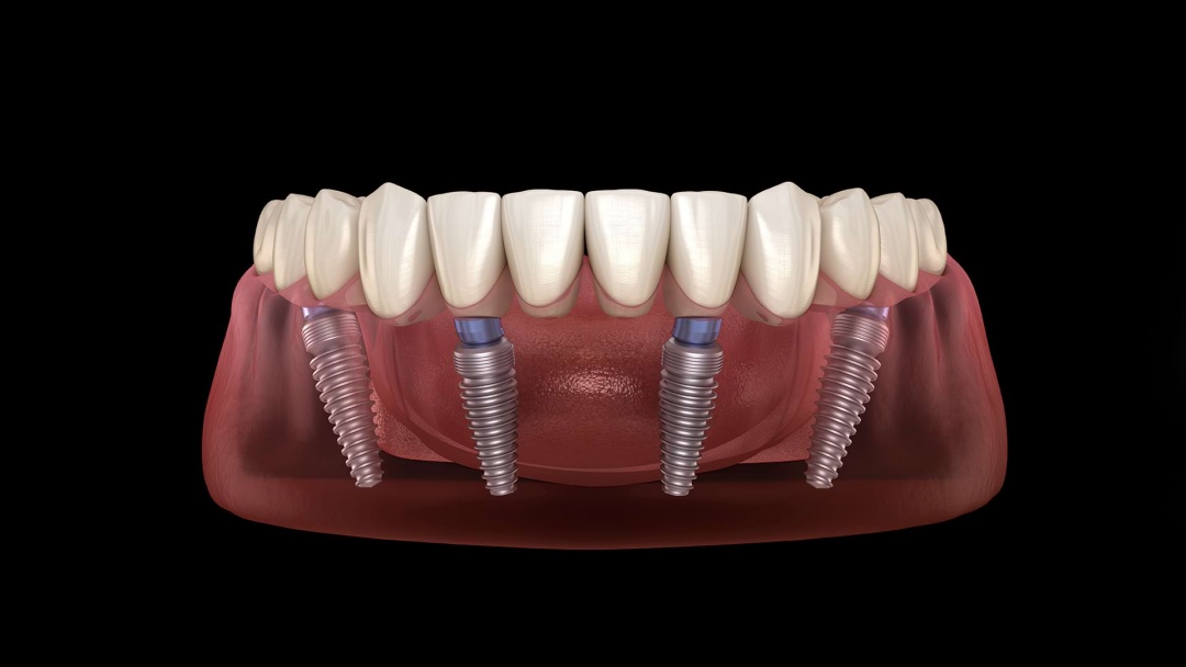 Cosmetic Dentistry