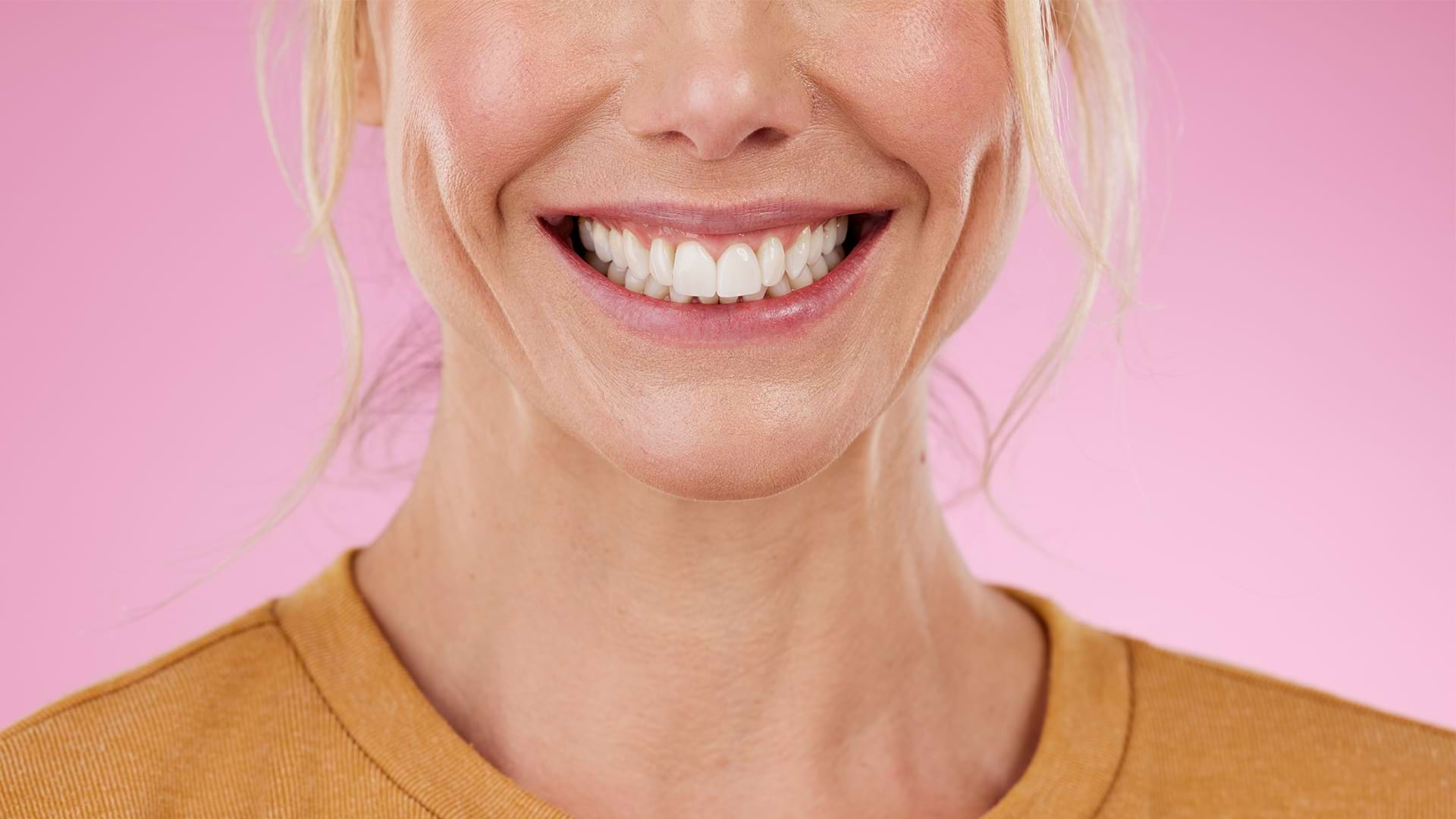 Hollywood Smile 101