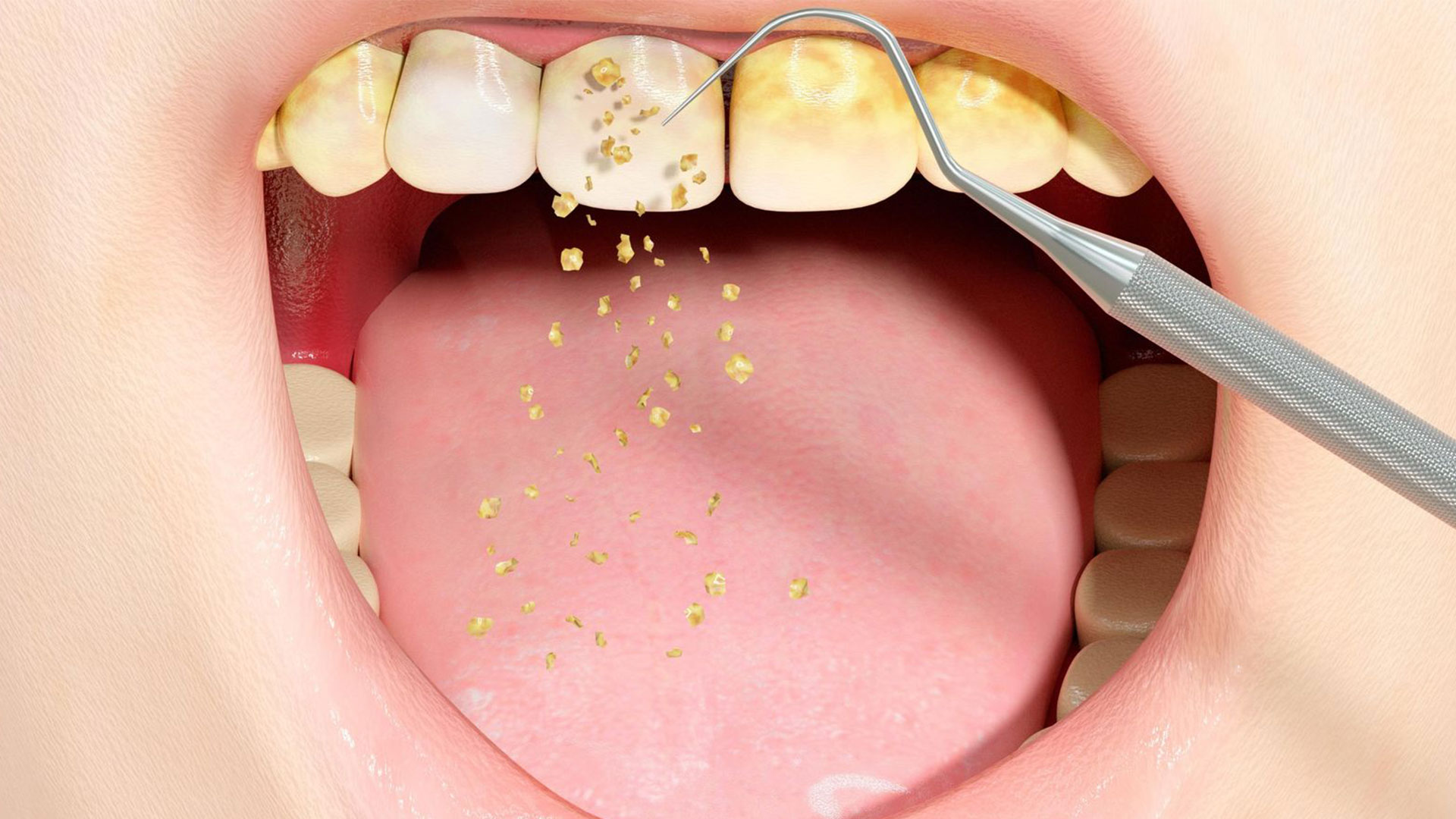 Why do gums get sick